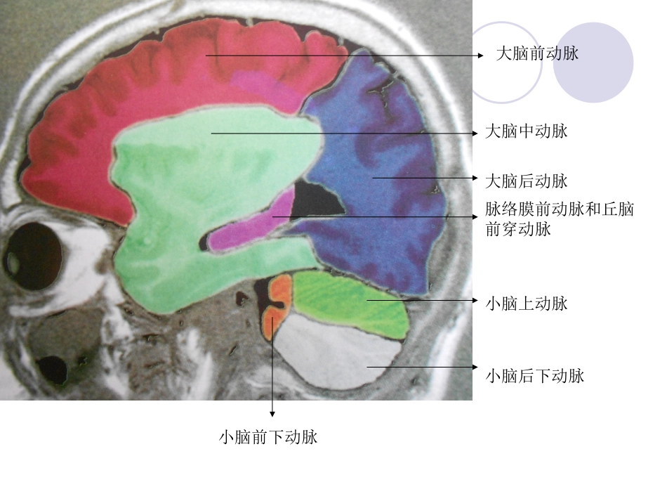 脑血管分布示意图_第3页