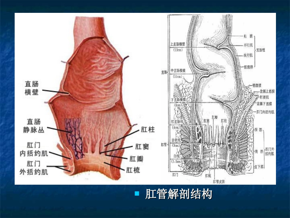 内外痔诊疗标准规范_第3页