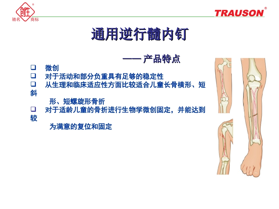逆行髓内钉小儿弹性髓内钉资料_第2页