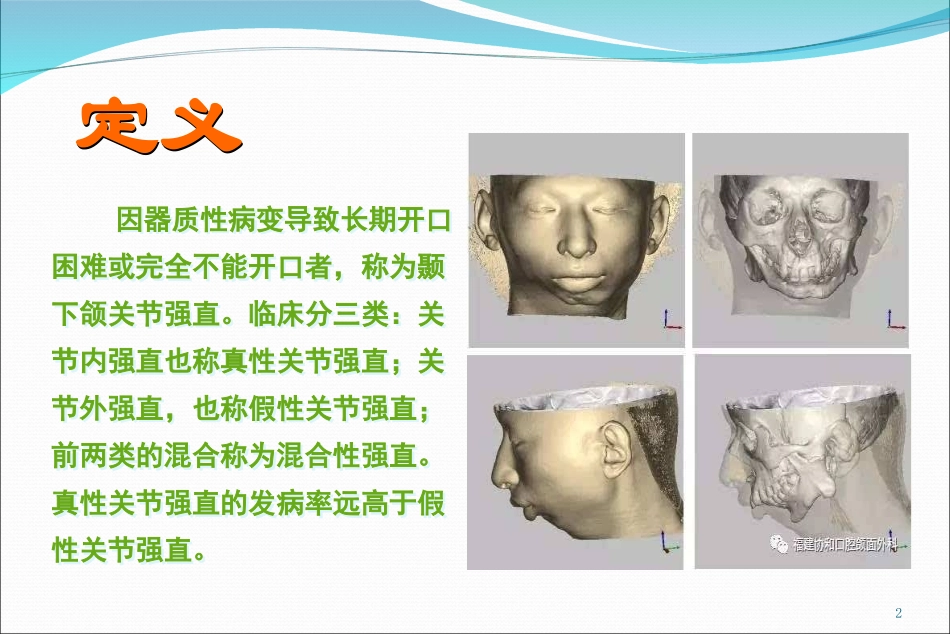 颞下颌关节强直_第2页