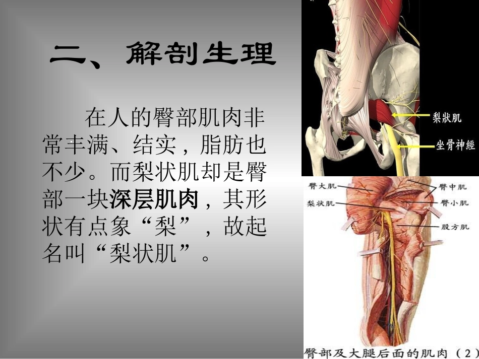 培训梨状肌综合征_第3页