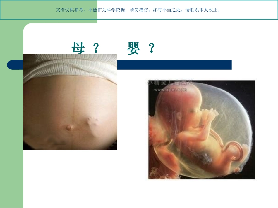 剖宫产麻醉操作规范课件_第1页