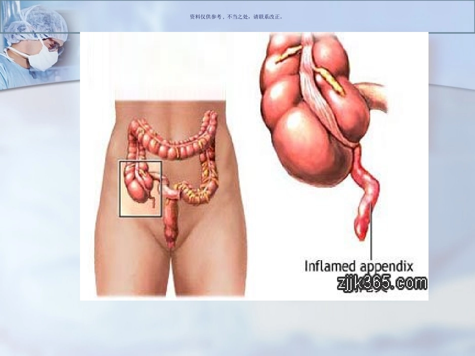 普外科护理业务查房_第2页