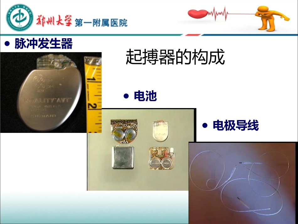 起搏器植入常见并发症及处置_第3页