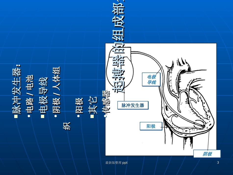 起搏器植入术后护理课件_第3页