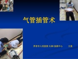 气管插管视频