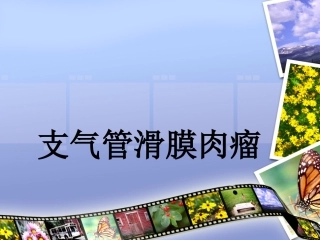 气管滑膜肉瘤