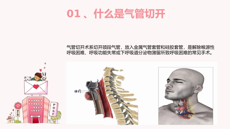 气管切开病人的护理yy_第3页