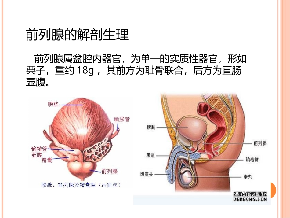 前列腺癌围手术期护理_第2页