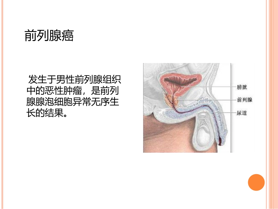 前列腺癌围手术期护理_第3页