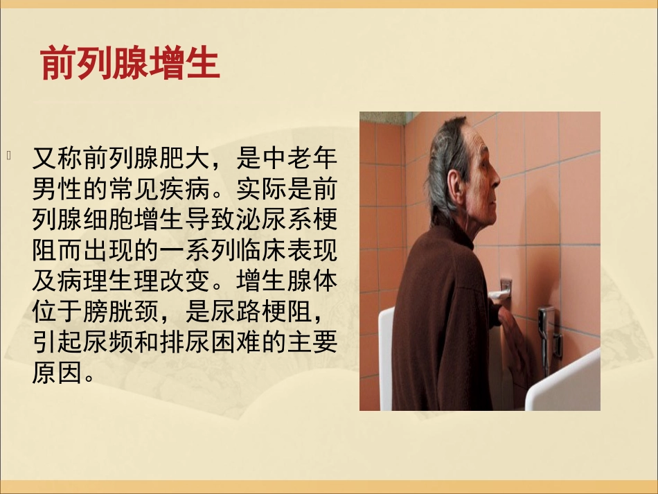 前列腺疾病的远期管理_第2页