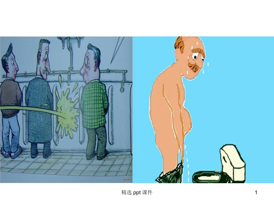 前列腺增生的护理查房最终版课件_第1页