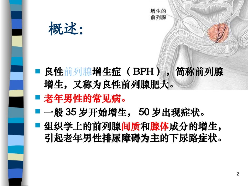前列腺增生的基础知识课件_第2页