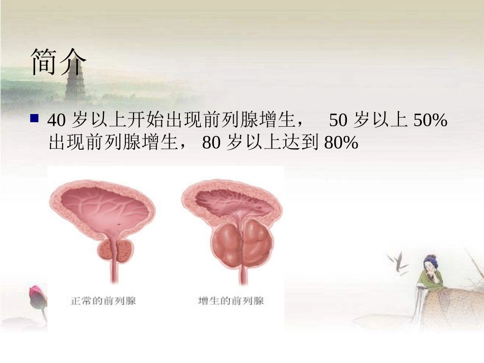 前列腺增生教学查房_第3页