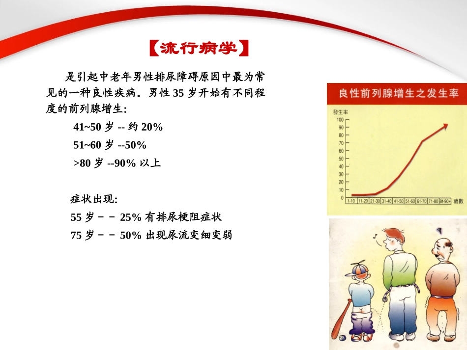前列腺增生教学课件_第2页