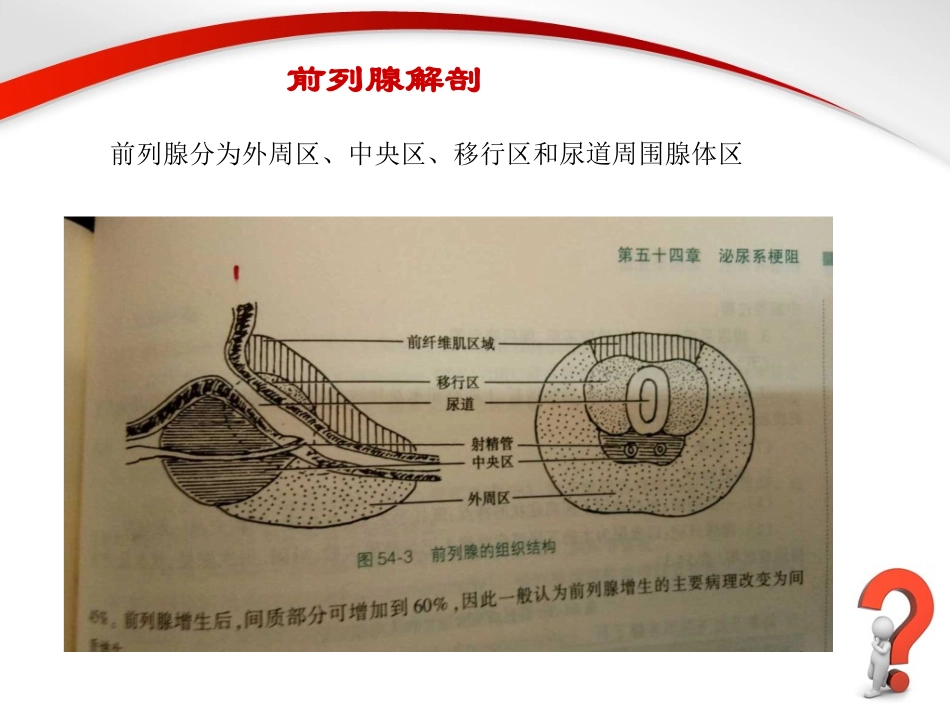 前列腺增生教学课件_第3页