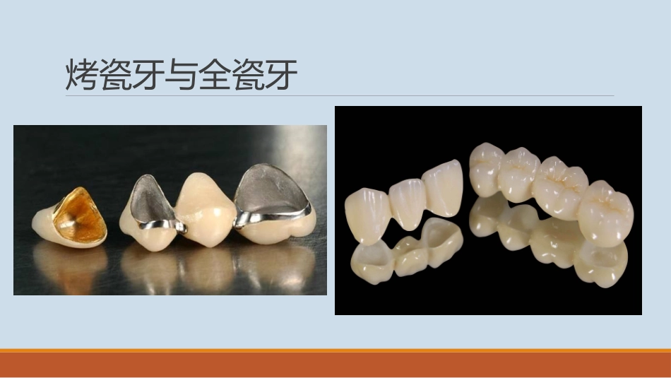 前牙美学修复_第2页