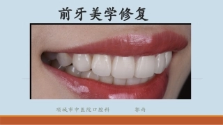 前牙美学修复