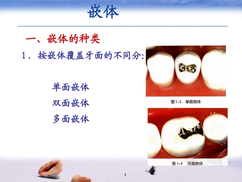 嵌体修复新幻灯片课件_第3页