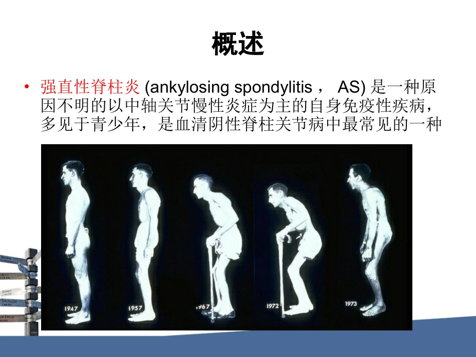 强直性脊柱炎SPARCC评分_第2页