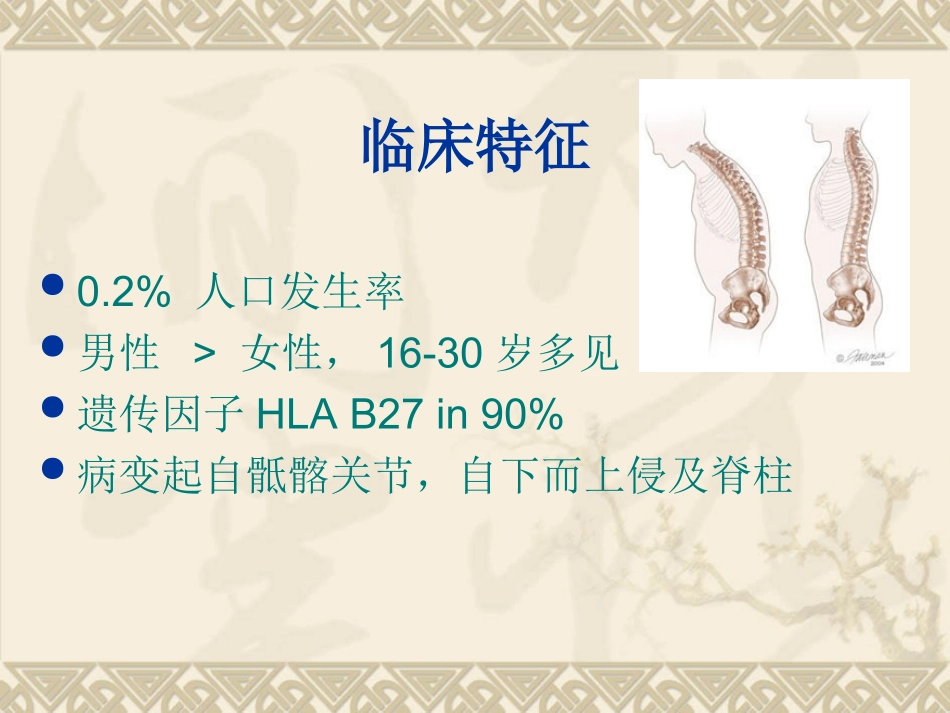 强直性脊柱炎课件_第2页