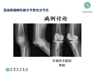 屈曲挛缩畸形膝关节骨性关节炎病例讨论