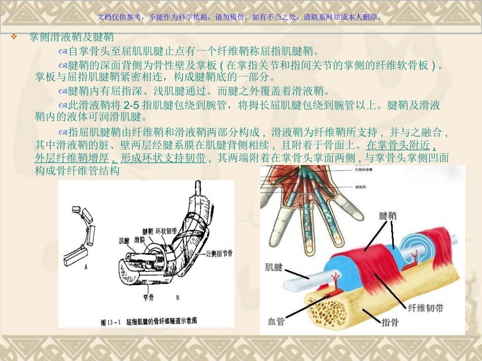 屈指肌狭窄性腱鞘炎课件_第3页