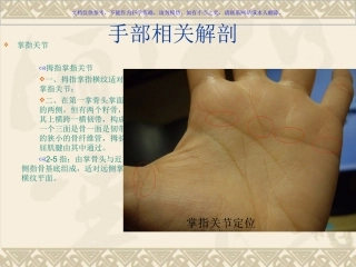 屈指肌狭窄性腱鞘炎课件
