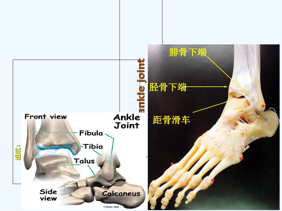 全踝关节置换术后的护理课件_第2页