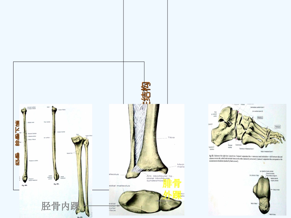 全踝关节置换术后的护理课件_第3页