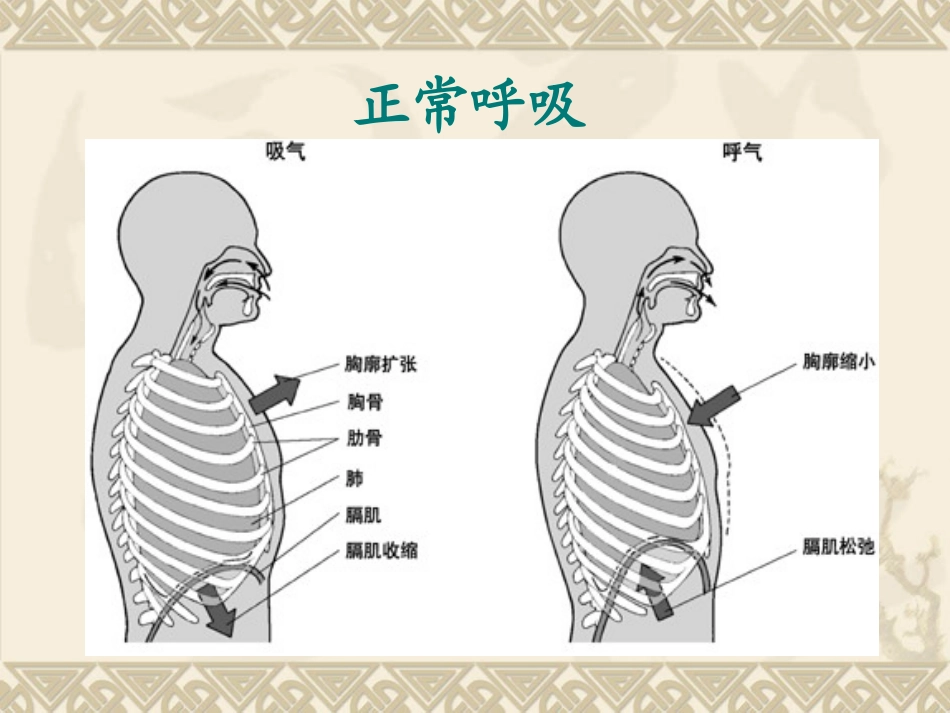 人工气道的建立和管理_第3页
