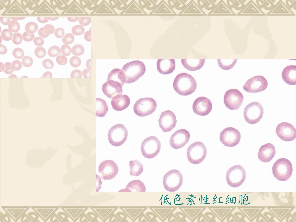 人体白细胞检查_第2页