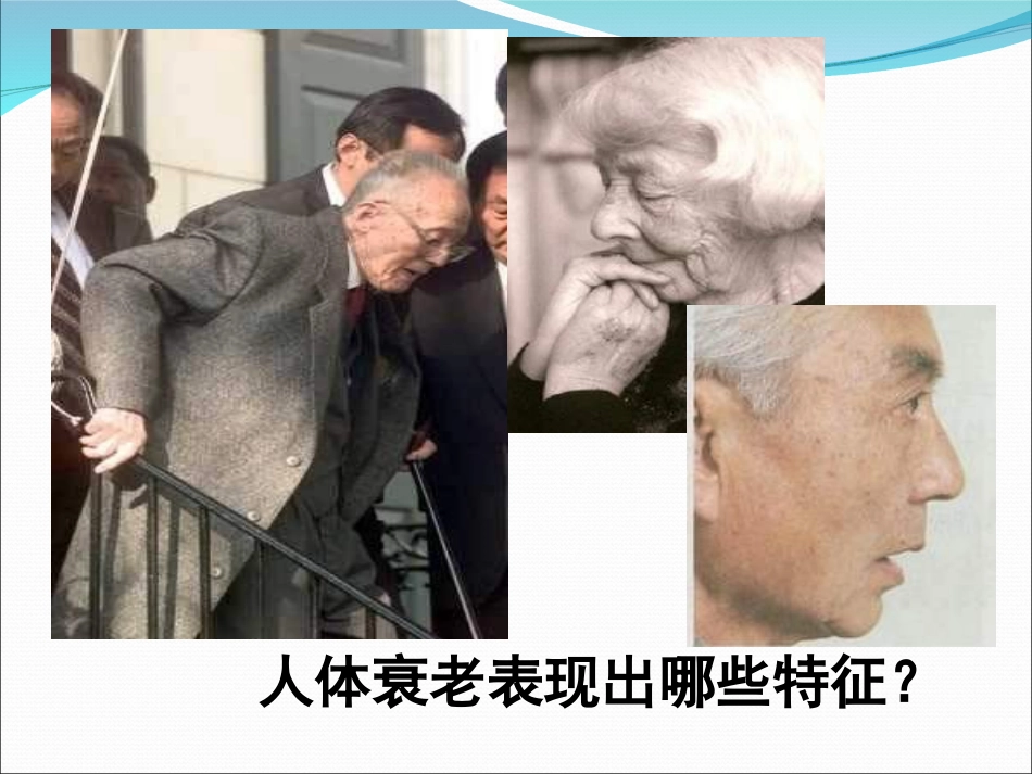 人体衰老表现出哪些特征_第2页