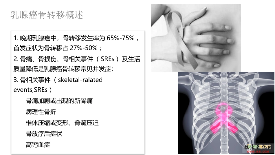 乳腺癌骨转移课件_第3页