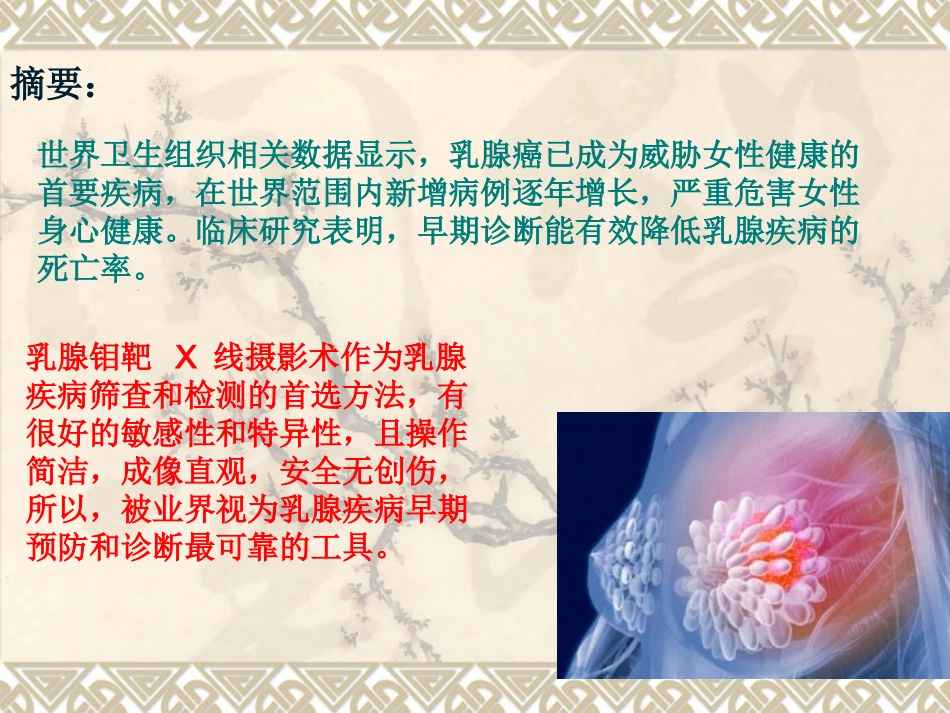 乳腺钼靶临床应用_第2页