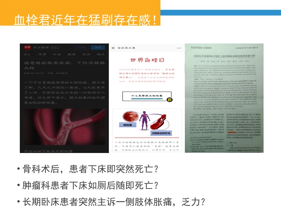 深静脉血栓知多少_第3页