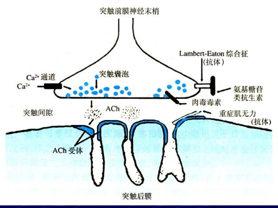 神经肌肉接头疾病_第3页