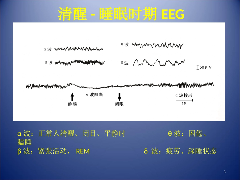 失眠及用药课件_第3页