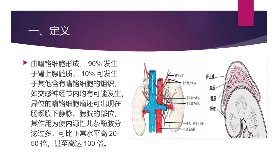 嗜铬细胞瘤切除术的麻醉管理课件_第3页