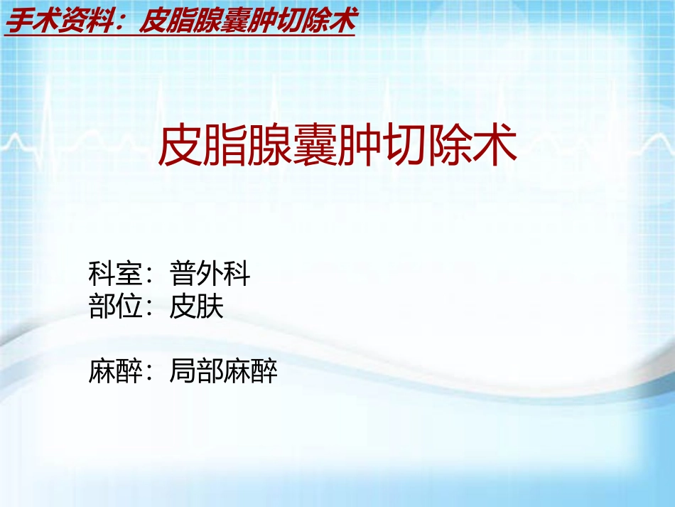 手术讲解模板皮脂腺囊肿切除术_第2页