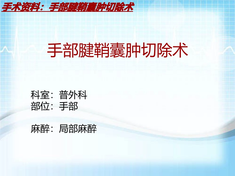 手术讲解模板手部腱鞘囊肿切除术_第2页