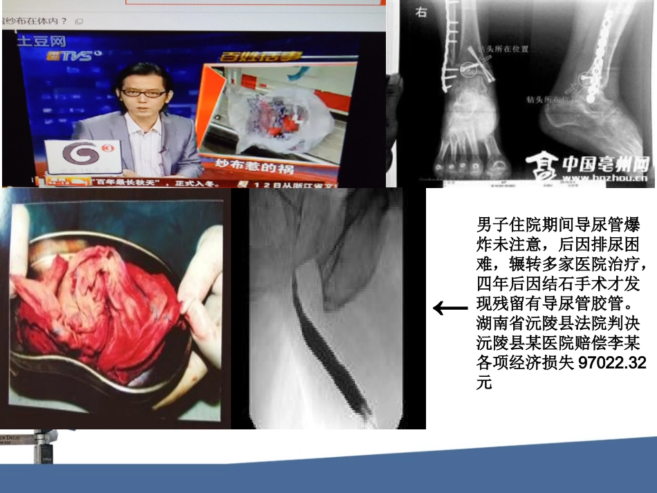 手术物品清点和核对_第2页