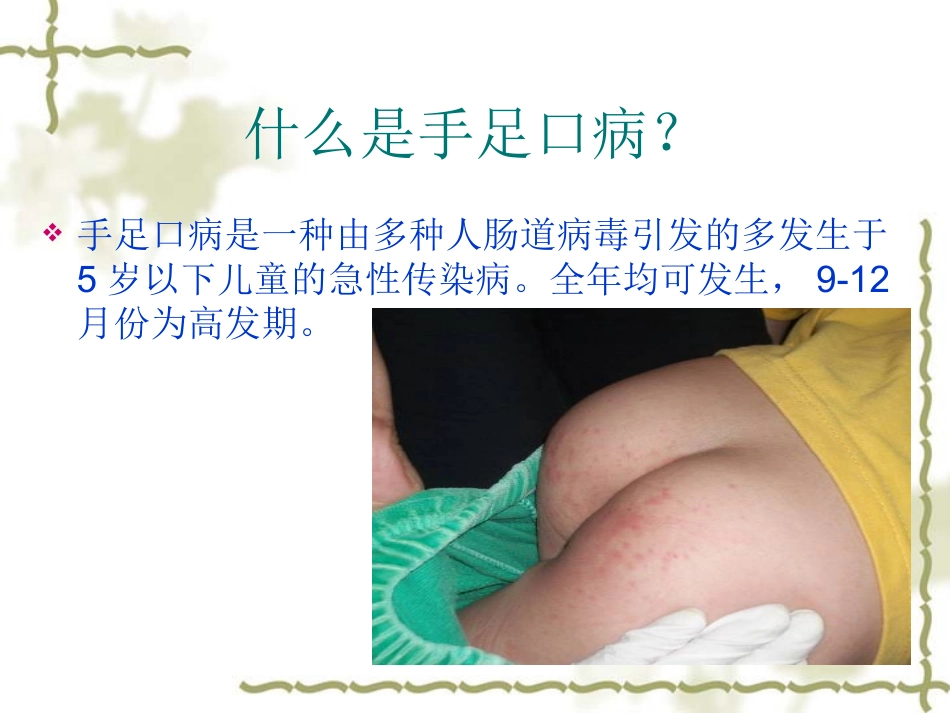 手足口病预防知识及中医保健_第2页
