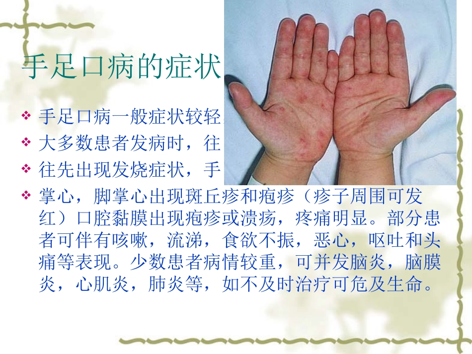 手足口病预防知识及中医保健_第3页