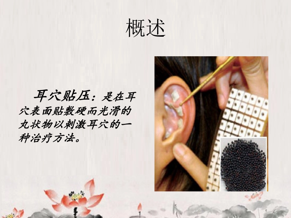 术前耳穴贴压的疗效观察_第2页