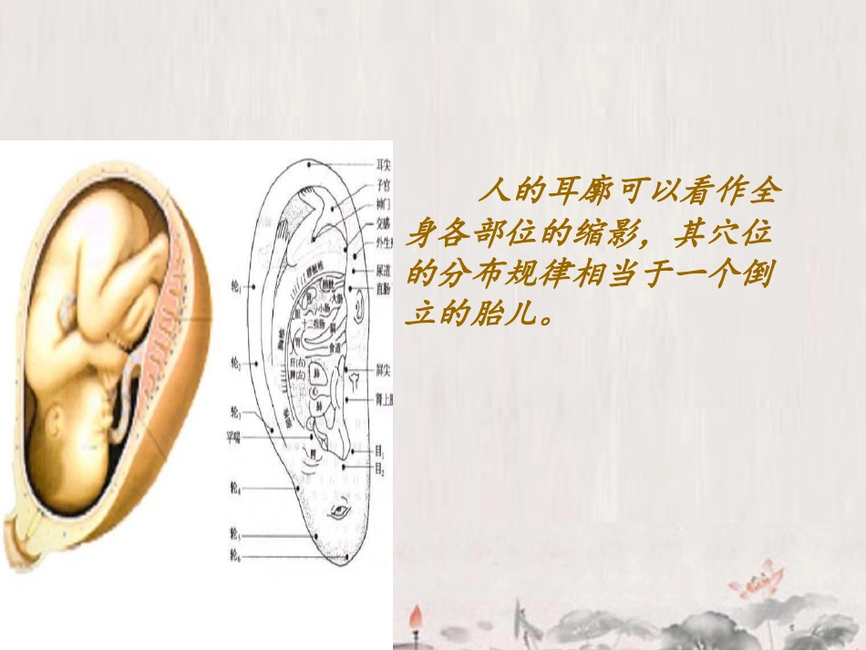 术前耳穴贴压的疗效观察_第3页