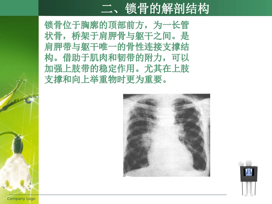 锁骨骨折的护理课件_第3页
