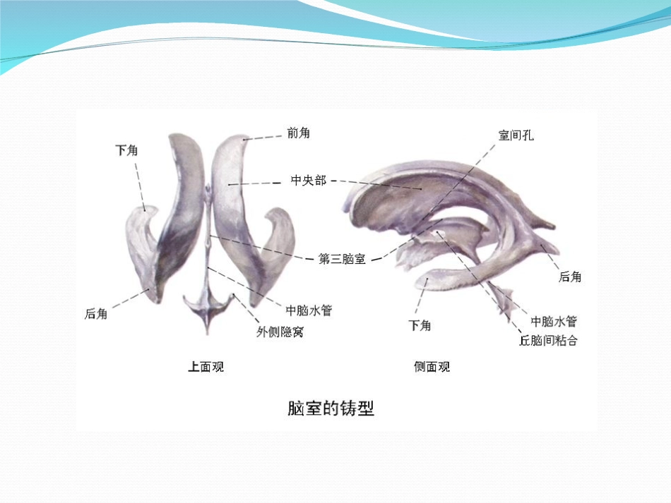 胎儿侧脑室增宽_第3页