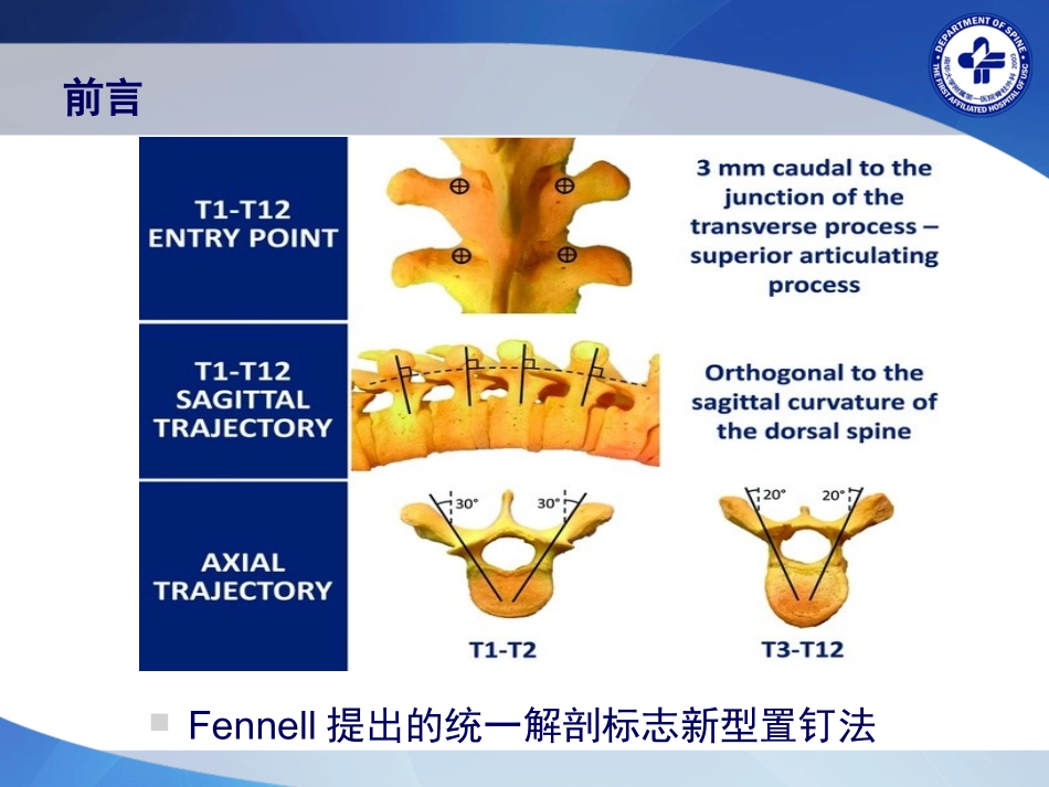 统一解剖标志徒手胸椎椎弓根置钉技术的初步应用_第3页