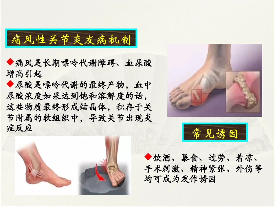 痛风性关节炎的中西医结合诊疗课件_第3页